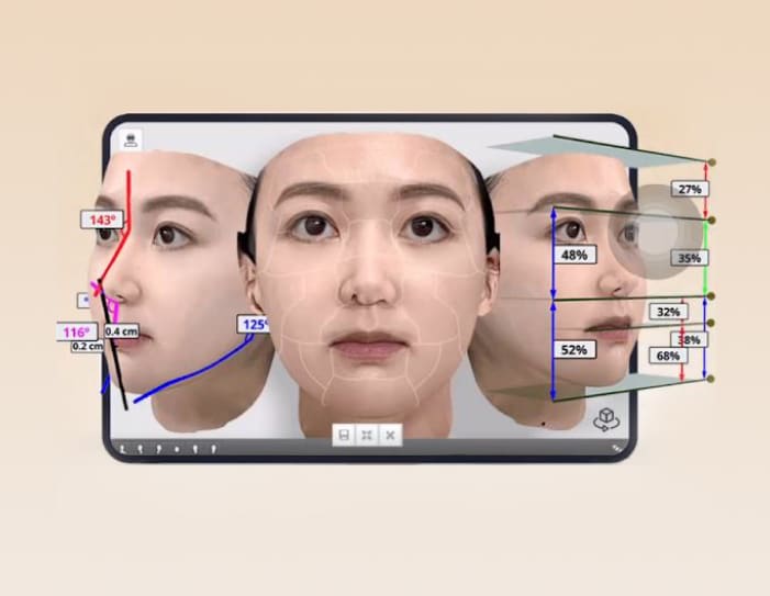 術前3D模擬圖