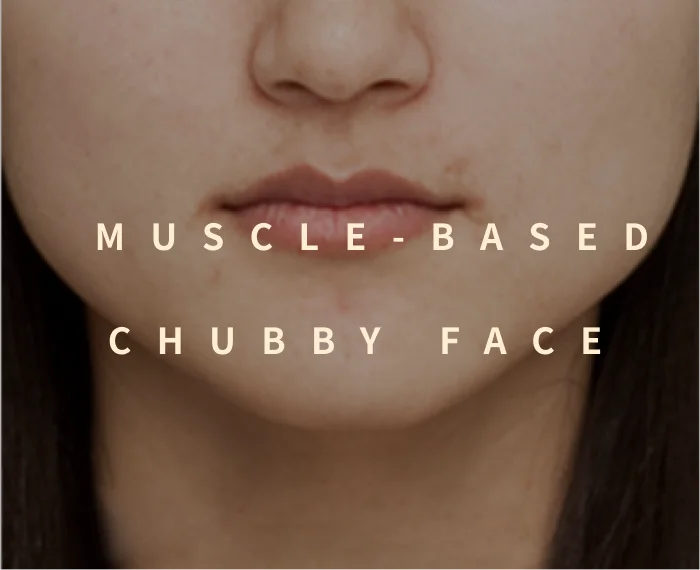 Muscle-Based Chubby Face