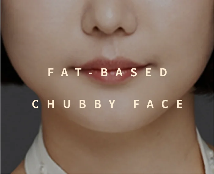Fat-Based Chubby Face