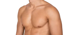 男性女乳手術