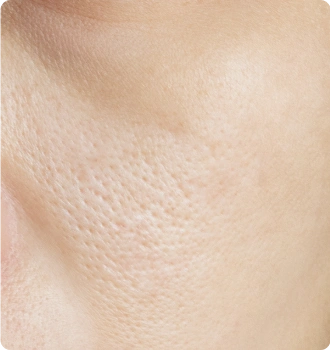 Large Pores