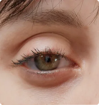 眼睛顯得疲憊無神