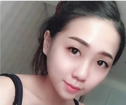 更多案例-告別單眼皮女孩 輕鬆擁有桃花電眼