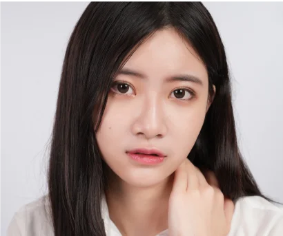 更多案例-不再撕貼雙眼皮貼 迎接閃亮有神大眼