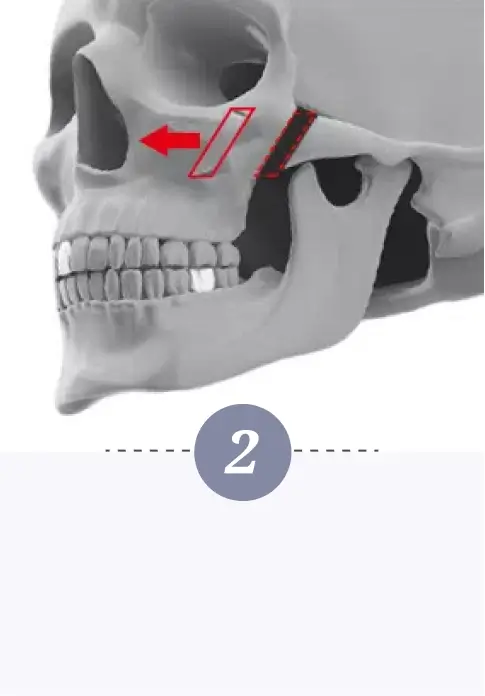 Cheekbone Contouring Step 2