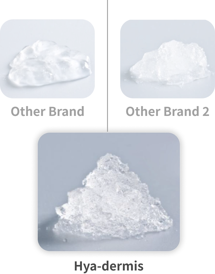 Viscosity and Elasticity - Comparison between Other Brands and Hya-Dermis