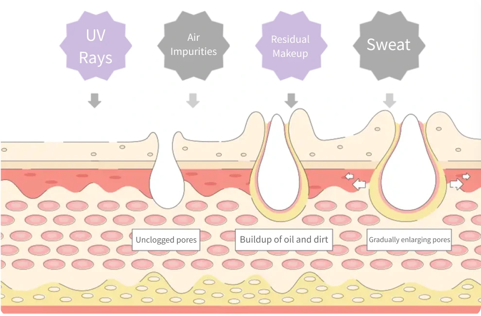 Pore issues illustration