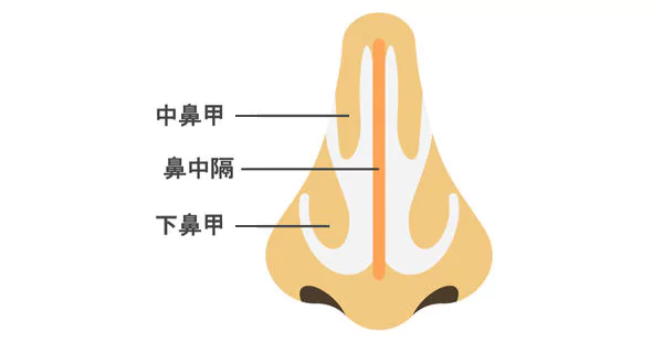 耳軟骨(修飾鼻尖)