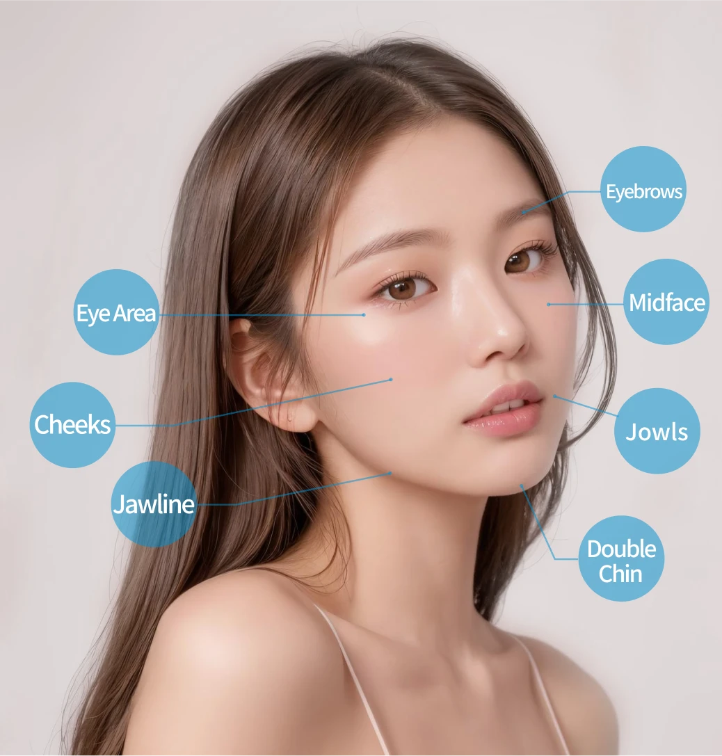Suitable lifting areas - eye area, cheeks, jawline, eyebrows, midface, jowls, double chin