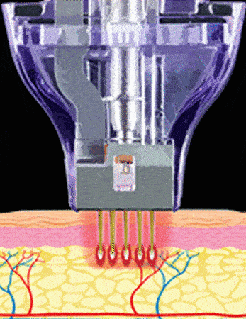 Static mode animation