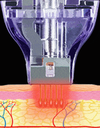 Continuous mode animation