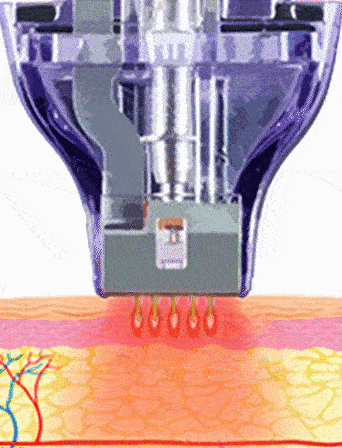Multi-layer mode animation
