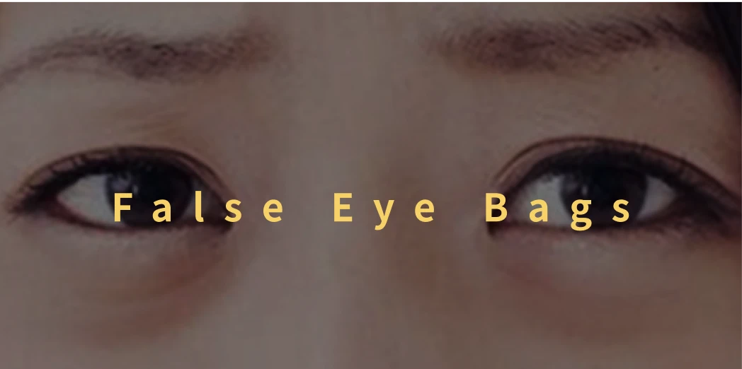 False Eye Bags