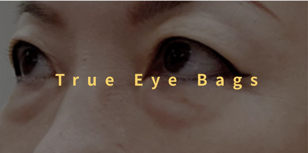 True Eye Bags