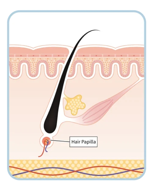 Regression phase pores