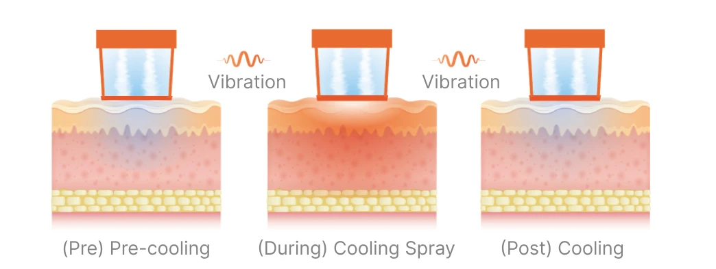 Cooling + Vibration System