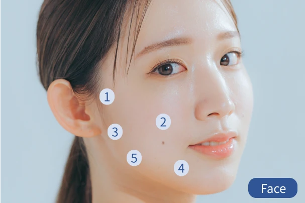 5-point injection for face