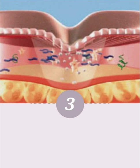 舒顏萃的作用模式-第三步驟