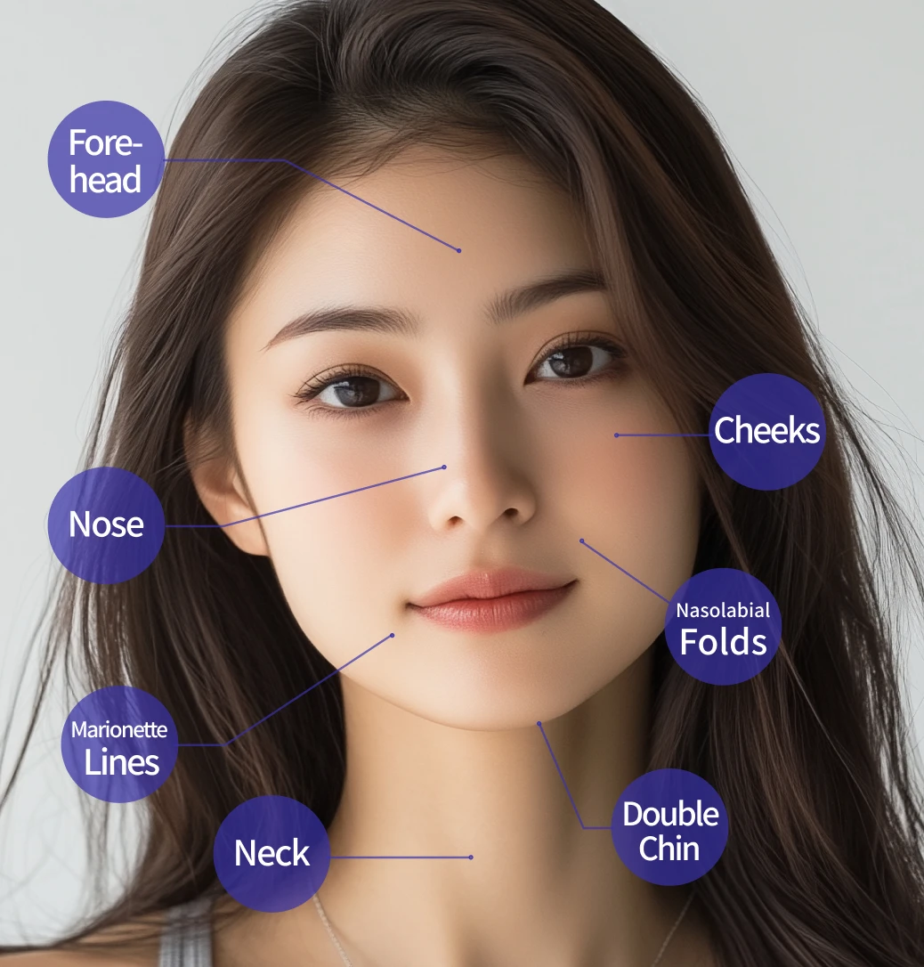 Treatment areas: forehead, nose, marionette lines, neck, double chin, cheeks, nasolabial folds