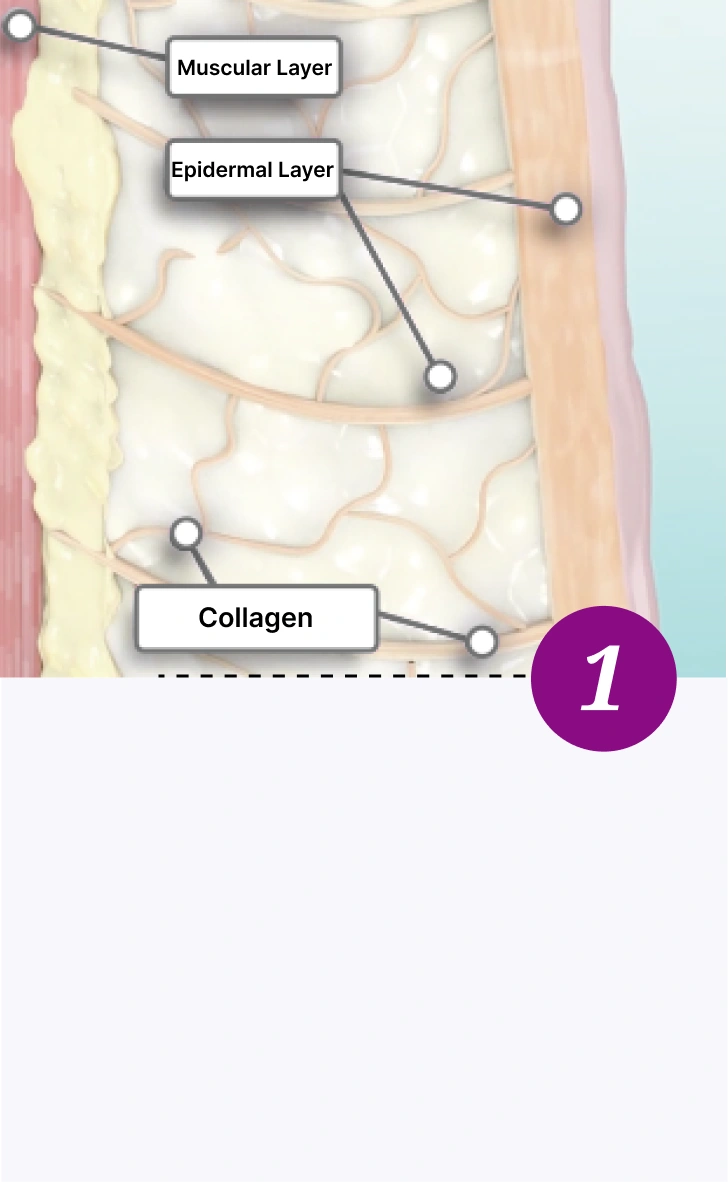Thermage FLX - Step One
