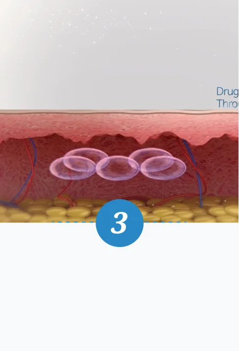 水光注射-第三步驟