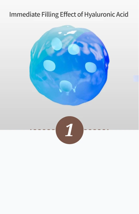 Magic Injection - Step 1