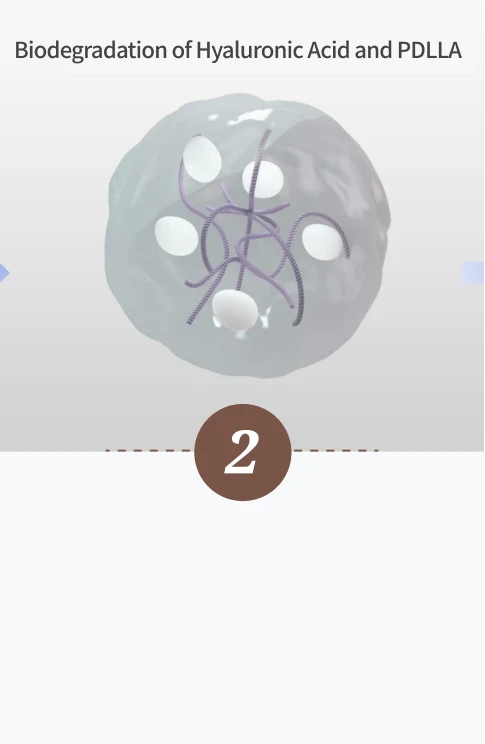 Magic Injection - Step 2