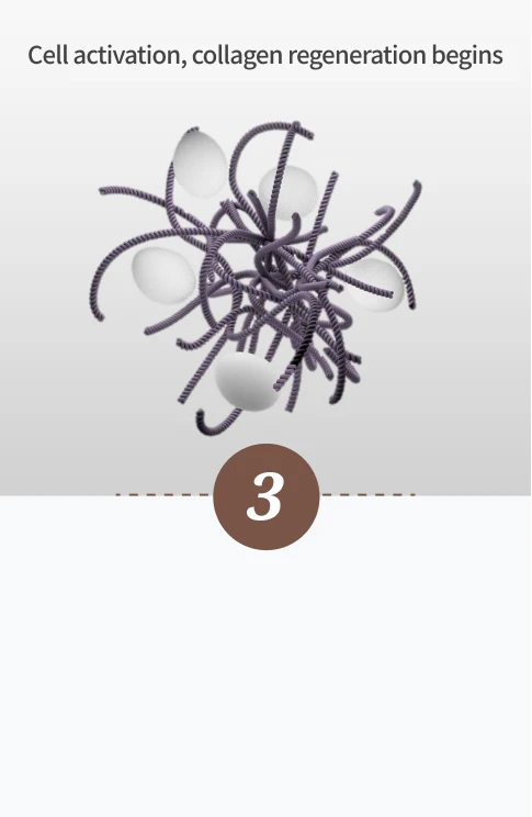 Magic Injection - Step 3