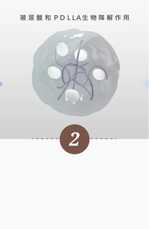 魔法針-第二步驟