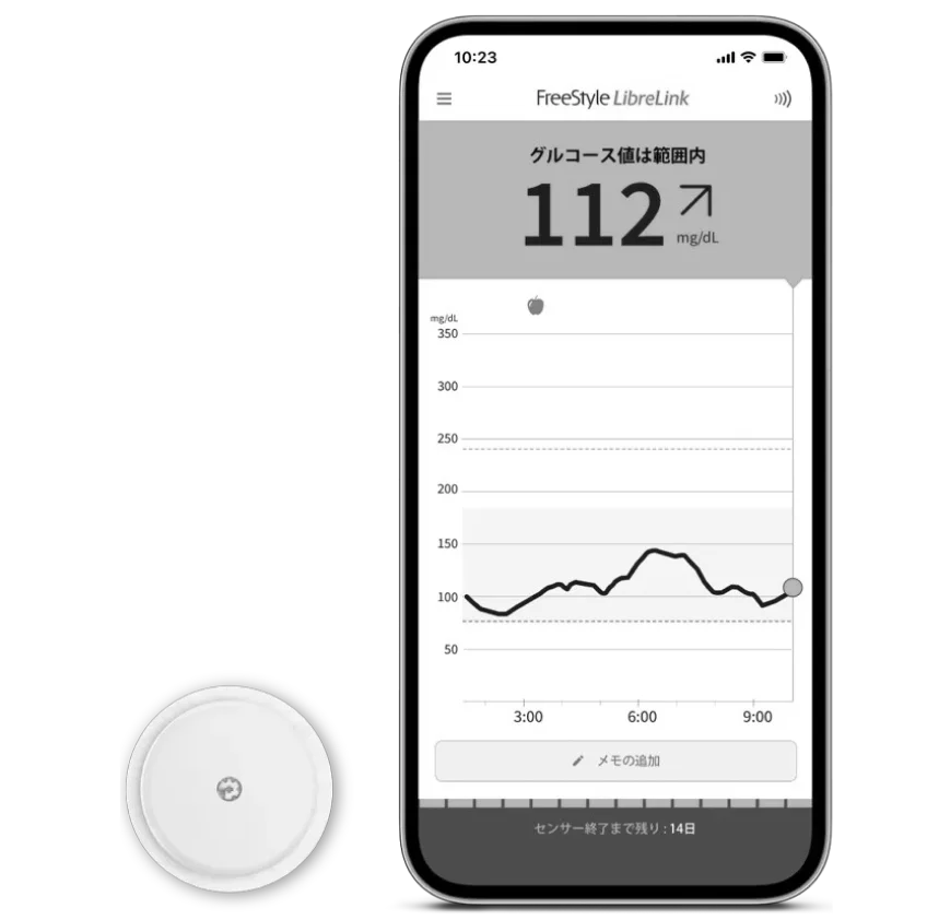 CGM continuous glucose monitoring app