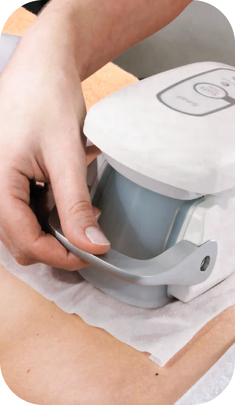 CoolTech fat freezing