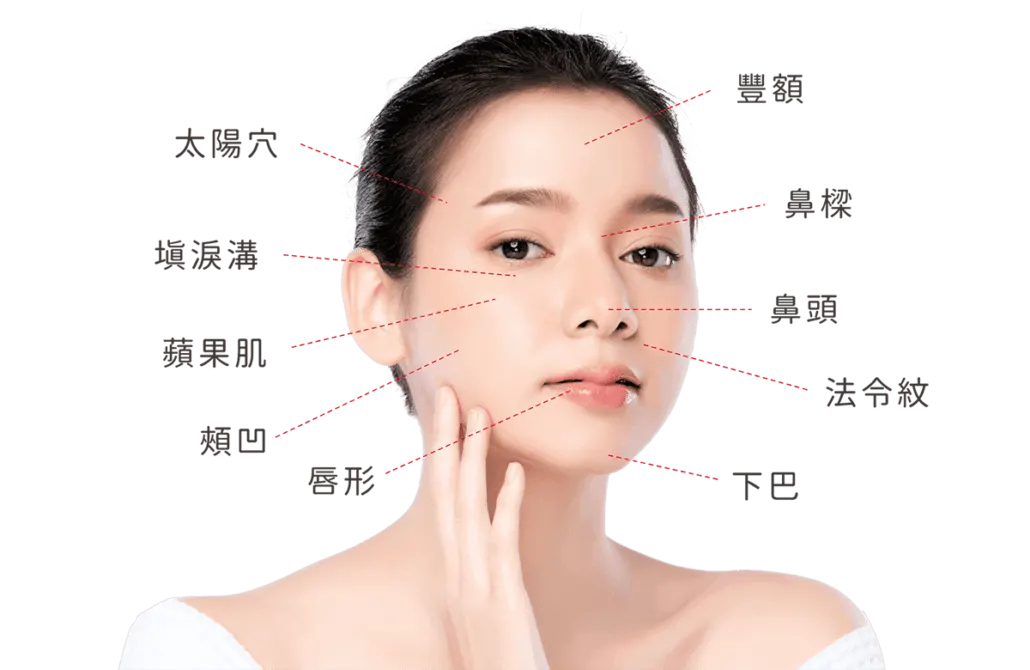 At this point, we can inject purified hyaluronic acid, which blends with the hyaluronic acid already in the body and fills hollows, wrinkles, and lines immediately, for a plump, dewy, youthful look. Applications include the apple cheeks, tear trough filling, nose augmentation, chin, cheek augmentation, and lip augmentation, which is one reason why hyaluronic acid is so popular.