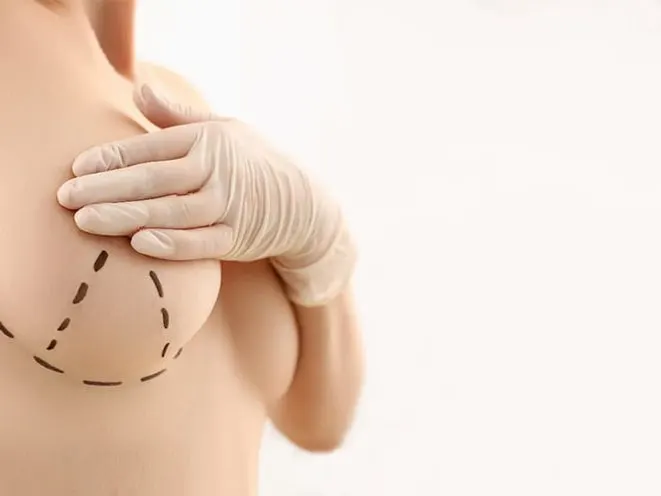 隆乳失敗機會大嗎？不讓隆乳後悔，就先瞭解手術風險與術後照顧重點