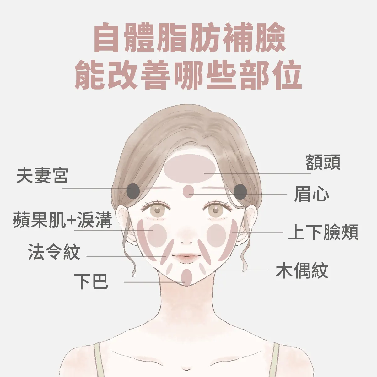 適合自體脂肪填補的部位有哪些？