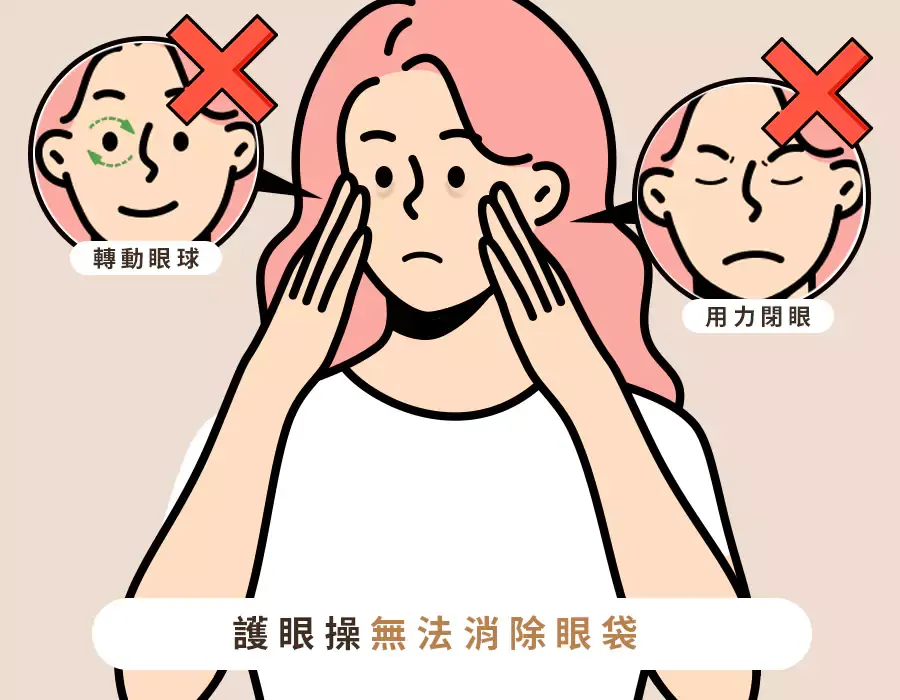 眼袋消除偏方2：勤作護眼操