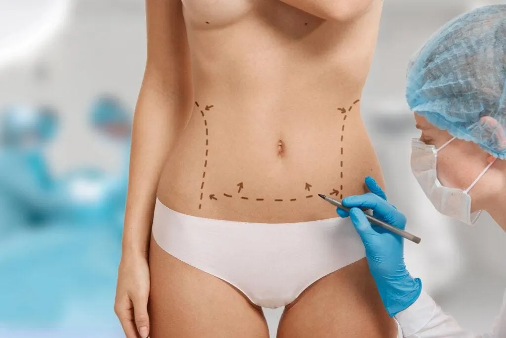 2024 Liposuction Costs Revealed: Price Ranges by Body Area