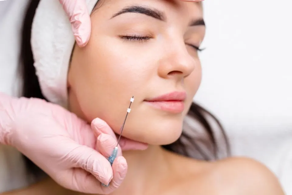 Hyaluronic acid or Botox for nasolabial folds? Comparing treatments