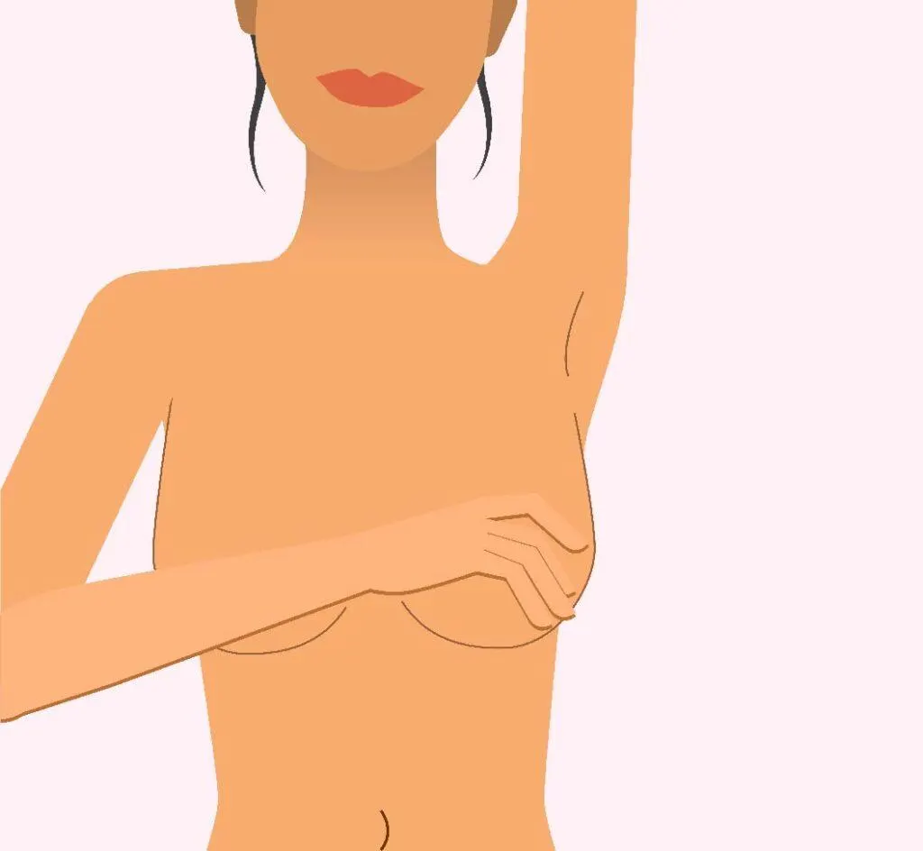 隆乳後遺症知多少？認識「莢膜攣縮」