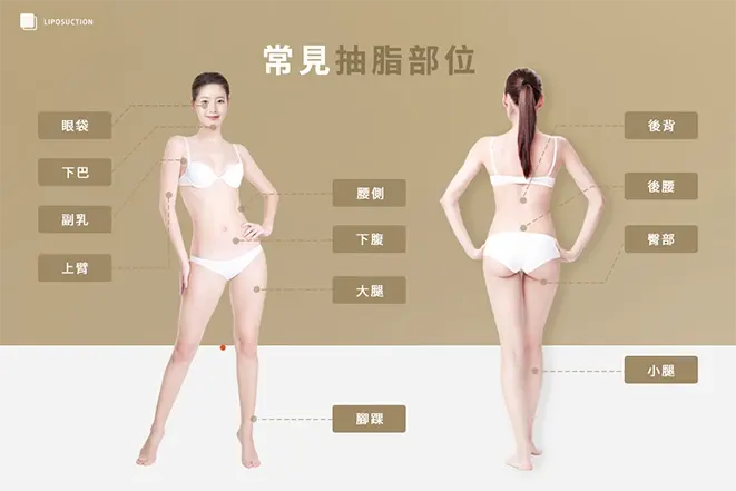 常見抽脂部位