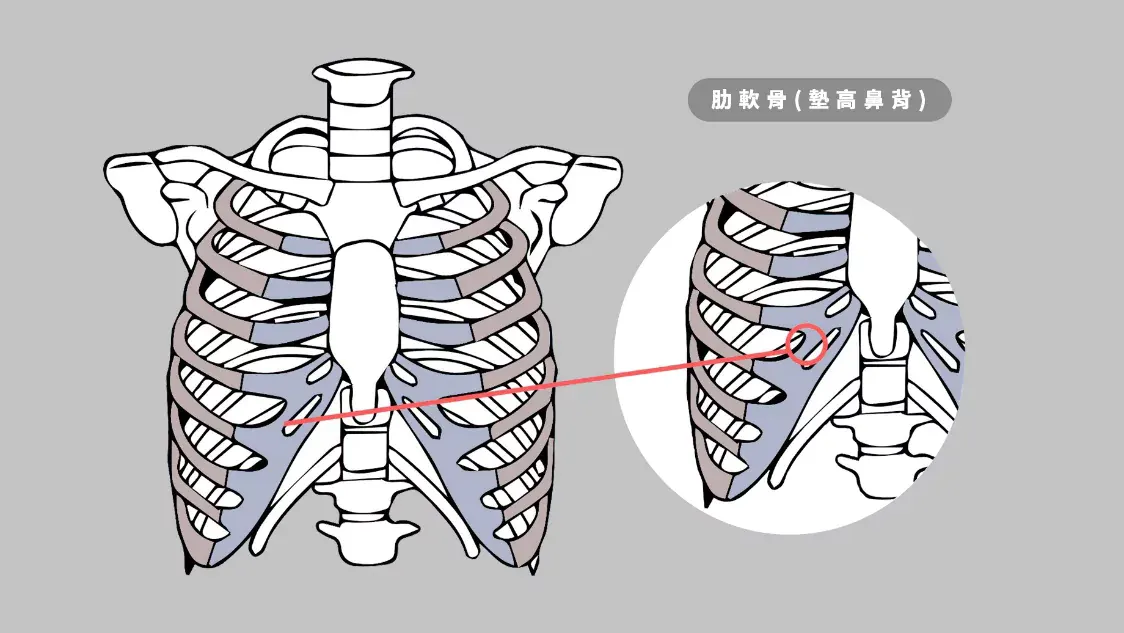 肋軟骨（墊高鼻背）
