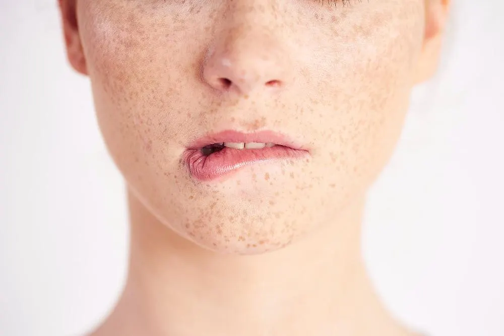 Dark Spot Treatments (2023): The One Influencers Recommend
