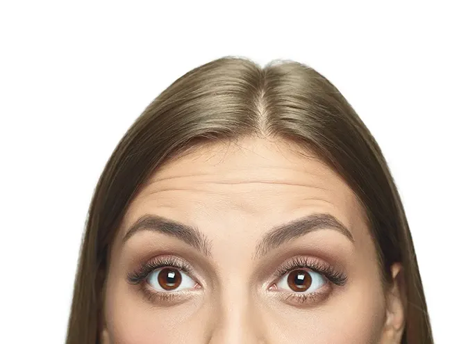 Dynamic vs. Static Wrinkles: How Botox Prevents Static Lines