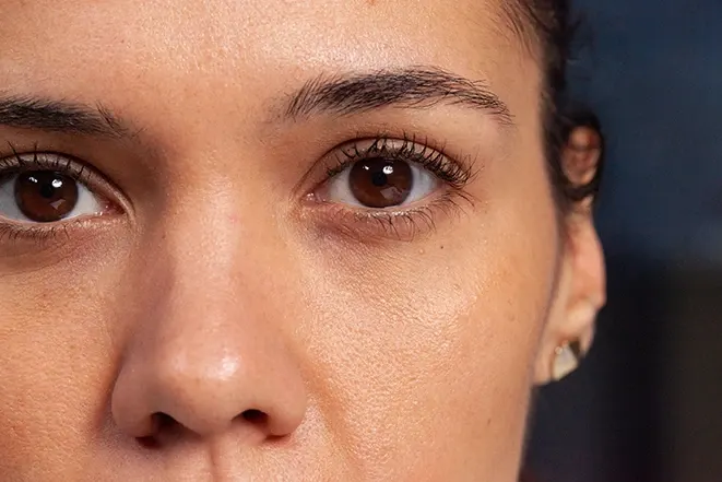 Does Whitening Eye Cream Fix Dark Circles? Getting Rid of Panda Eyes