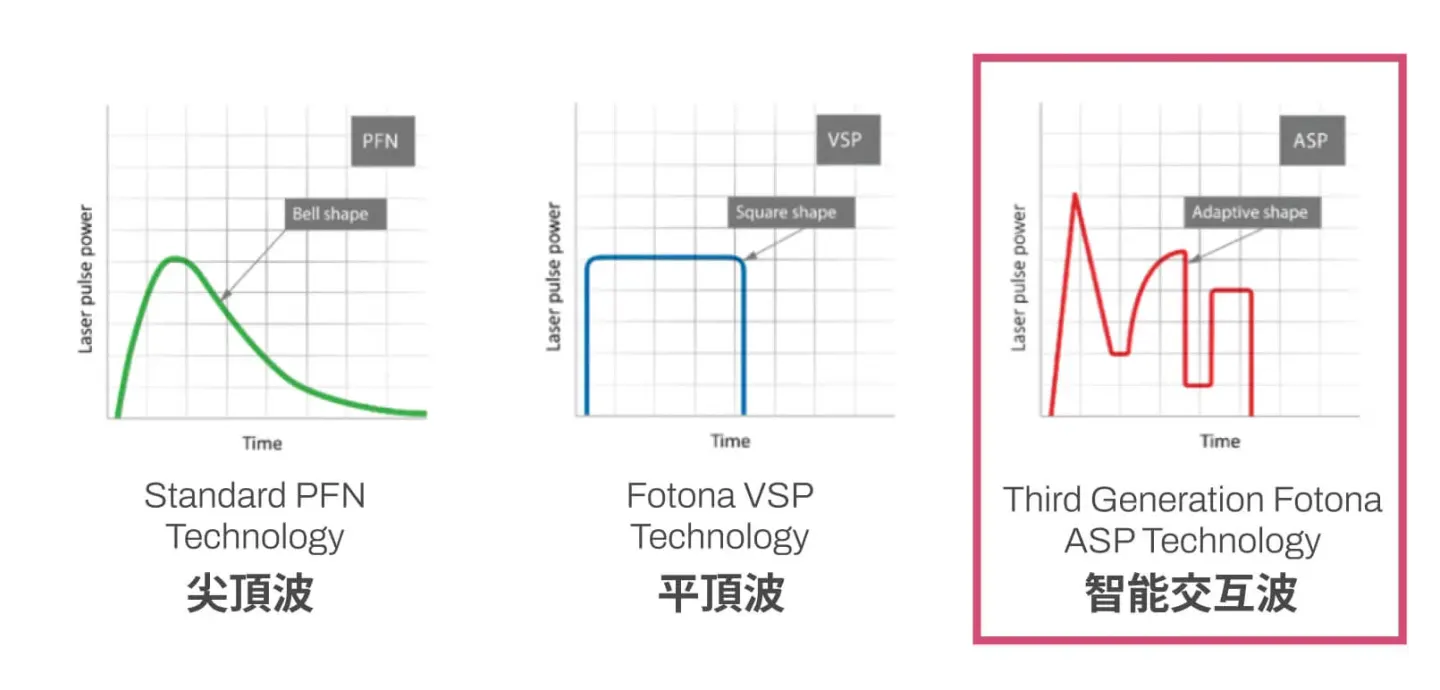 Patented ASP smart pulse technology