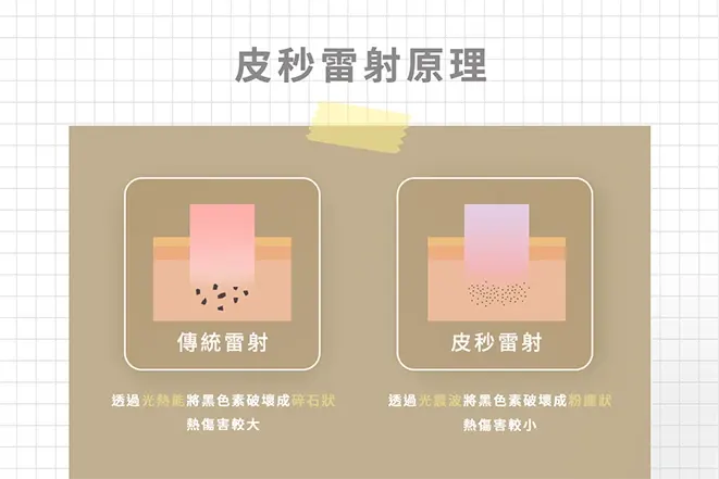 皮秒雷射原理