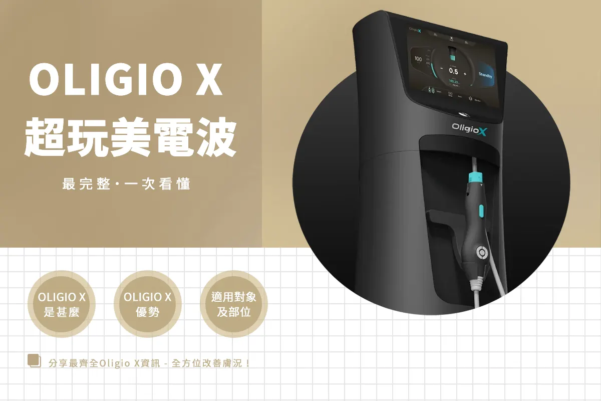 全新「Oligio X 超玩美電波」是什麼？優勢、適用對象及部位一次看懂