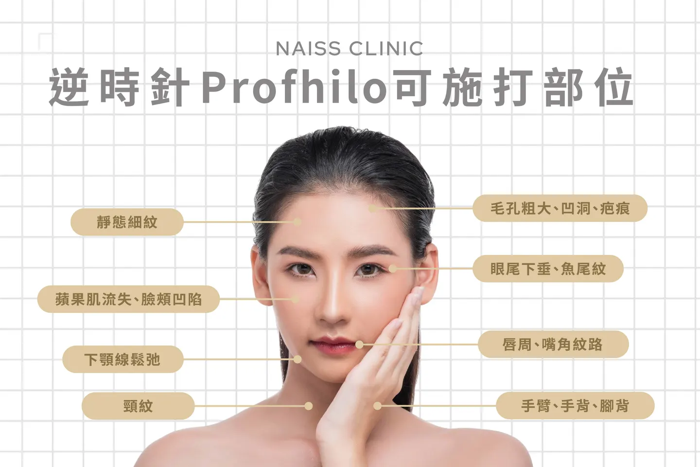 逆時針Profhilo可施打部位​
