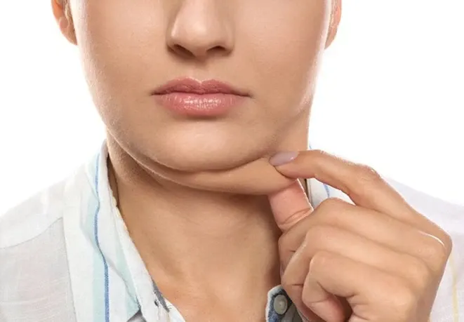 Double Chin from Fat: Lipolysis Injections vs. Neck Lift