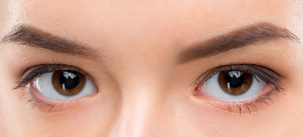 (1) Double eyelids: Visually, double eyelids give the impression of being more energetic, easygoing, and approachable, while monolids look less lively, with a sense of individuality and mysterious distance, and may be harder to approach.

If you were born with less subcutaneous fat in your eyelids, the “suture” method (stapler-style stitching) can create the double eyelid crease, with quick swelling reduction and short downtime after the procedure. If you have more subcutaneous fat in your eyelids, we recommend the incisional method, which removes excess eyelid skin and subcutaneous fat during the operation, though the operation takes slightly longer and recovery is a bit longer too.

(2) Eye shape: Peach blossom eyes are commonly defined as a longer shape with the outer corners slightly lifted, forming a crescent-moon shape when smiling. If your natural eye shape is less than ideal, we recommend first checking the distance between your eyes and then having surgery on the inner or outer corner to adjust it.

(3) Tear troughs, eye bags, and aegyo sal: The condition around the eyes also affects the overall effect. For example, tear troughs and eye bags can make you look tired and older, and the problem can be solved by eye bag removal surgery and autologous fat grafting.

If tear troughs are not too severe and you want to create peach blossom aegyo sal, minimally invasive filler injections can be used, such as hyaluronic acid filler, youth needle, AestheFill, and collagen stimulators, all of which can fill hollows, strengthen support for sagging tissue or stimulate regeneration, and add fullness.

(4) Skin around the eyes: People who are expressive or love to smile move the skin around their eyes a lot, which may speed up aging of that skin or the formation of lines. A common problem is crow's feet, which can be treated with Botox injections to smooth the lines quickly, and the results can last for half a year or so.

In addition, skin aging with age can lead to slack skin and more fine lines around the eyes, and you can also use Thermage FLX eye treatment, using RF heat to stimulate collagen remodeling, precisely improving aging around the eyes and eliminating fine lines and slackness.
