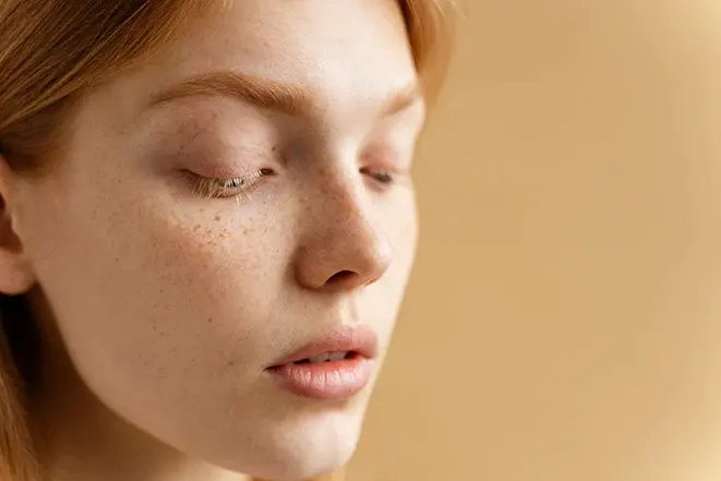 Can Sun Spots Be Removed? Spot Types, Causes, and Treatments